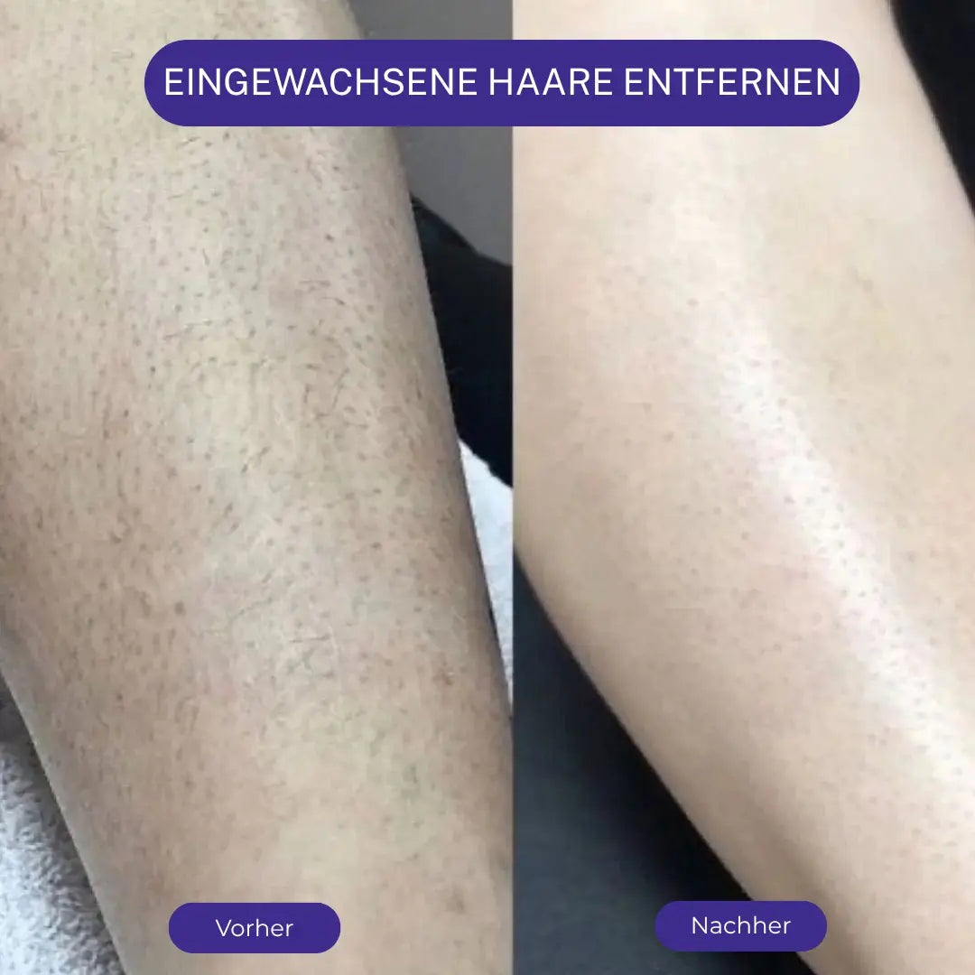 Velina Schmerzfreie Haarentfernungs-Creme für den Körper